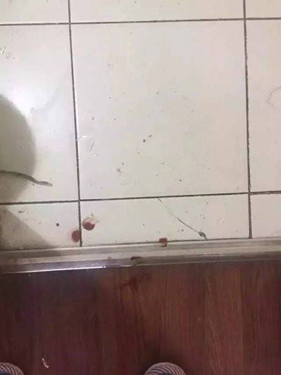 宜家水杯又发生爆炸事故 北京女子当场被炸晕